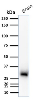 CALB2 Antibody