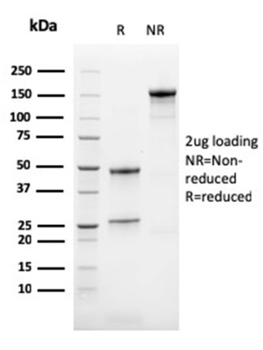 CALB2 Antibody