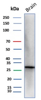 CALB2 Antibody