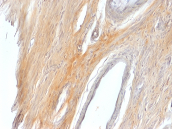 CALD1 Antibody