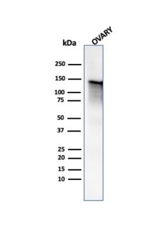 CALD1 Antibody