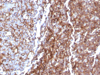 CD44 Antibody