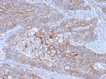 CDH1 Antibody