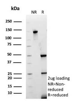 COL4A1 Antibody