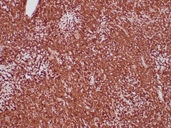 ALDH1A1 Antibody