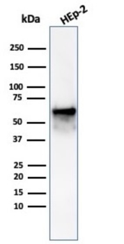 HSPD1 Antibody