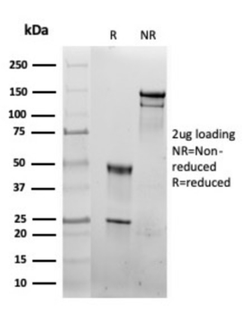 HSPD1 Antibody