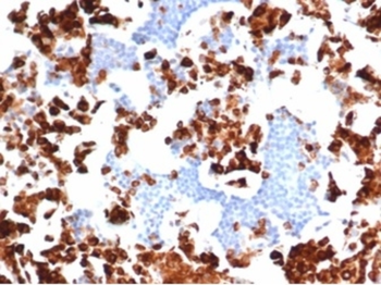 MPO Antibody
