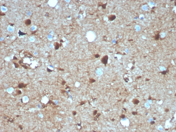 S100B Antibody
