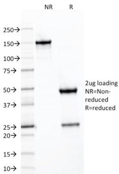 SDHB Antibody