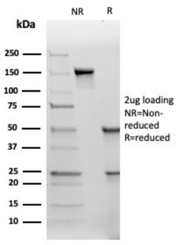 TIMP2 Antibody