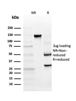 INSM2 Antibody