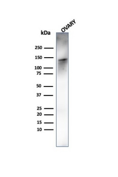 CALD1 Antibody