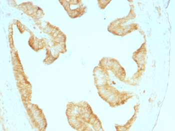 KRT6A Antibody