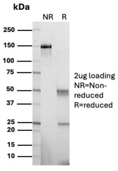 KRT6A Antibody
