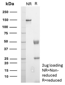 CD81 Antibody