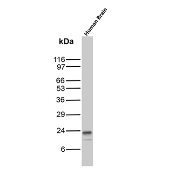 CD81 Antibody