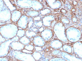 COL4A1 Antibody