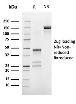 ESR1 Antibody (Biotin)