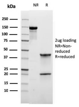 RORC Antibody