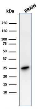 UCHL1 Antibody