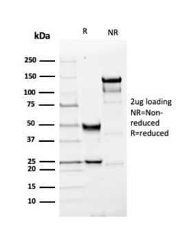 UCHL1 Antibody