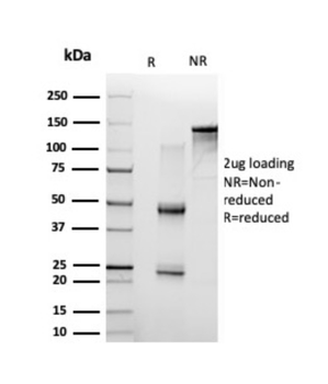 RELA Antibody