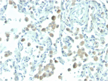 MSLN Antibody (Biotin)