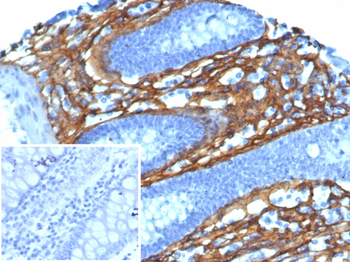 POSTN Antibody