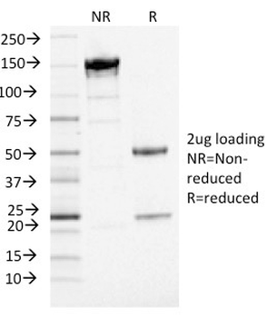 PD-L1 / PDCD1LG1 / CD274 / B7-H1 (Cancer Immunotherapy Target) Antibody