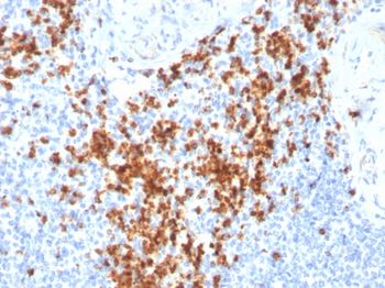 Granzyme B (NK/T-Cell Lymphoma Marker) Antibody