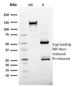 Ki-67 (Proliferating Cell Marker) Antibody