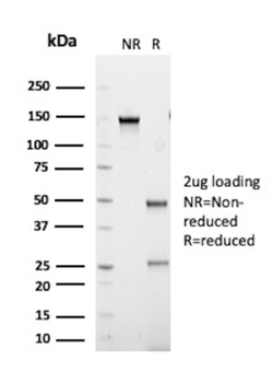HAVCR2 Antibody