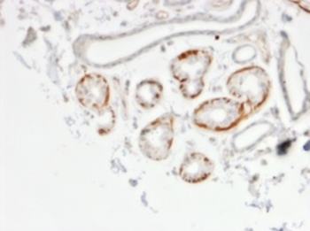 GTF2H2C, GTF2H2C_2 Antibody