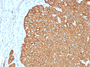KRT5 Antibody