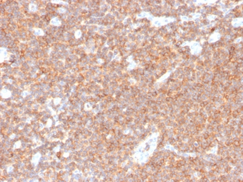 CD44 Antibody