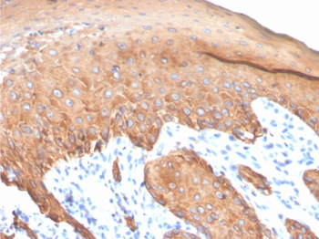 KRT77 Antibody