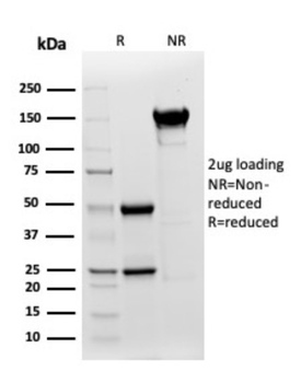 KRT77 Antibody