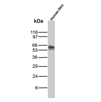 KRT5 Antibody