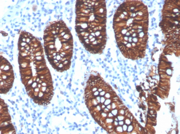EPCAM Antibody