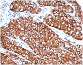 CDH1 Antibody