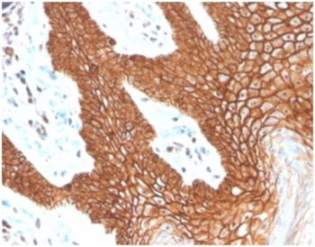 CDH1 Antibody