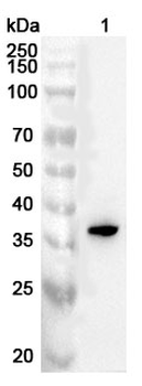 SIX1 Rabbit Polyclonal Antibody