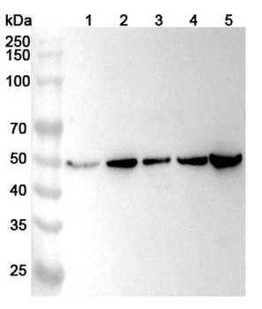 FECH Rabbit Polyclonal Antibody