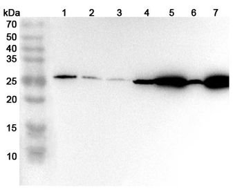 MGST1 Rabbit Polyclonal Antibody