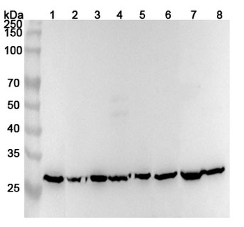 ECHS1 Rabbit Polyclonal Antibody