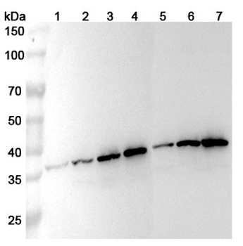 ZWINT Rabbit Polyclonal Antibody