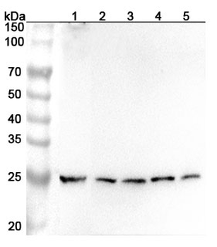 NAXE Rabbit Polyclonal Antibody