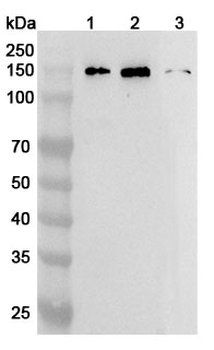 MYPN Rabbit Polyclonal Antibody