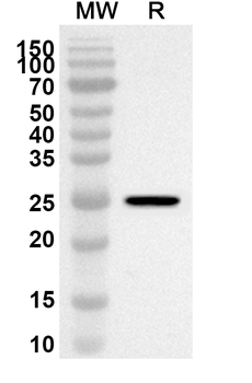 AUP1 Rabbit Polyclonal Antibody